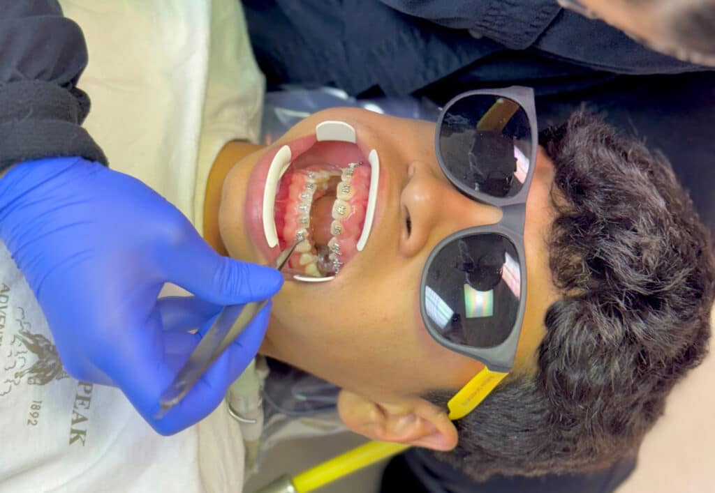 Metal Braces in Harrisonburg at Giardina Orthodontics