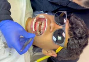 Metal Braces in Harrisonburg at Giardina Orthodontics