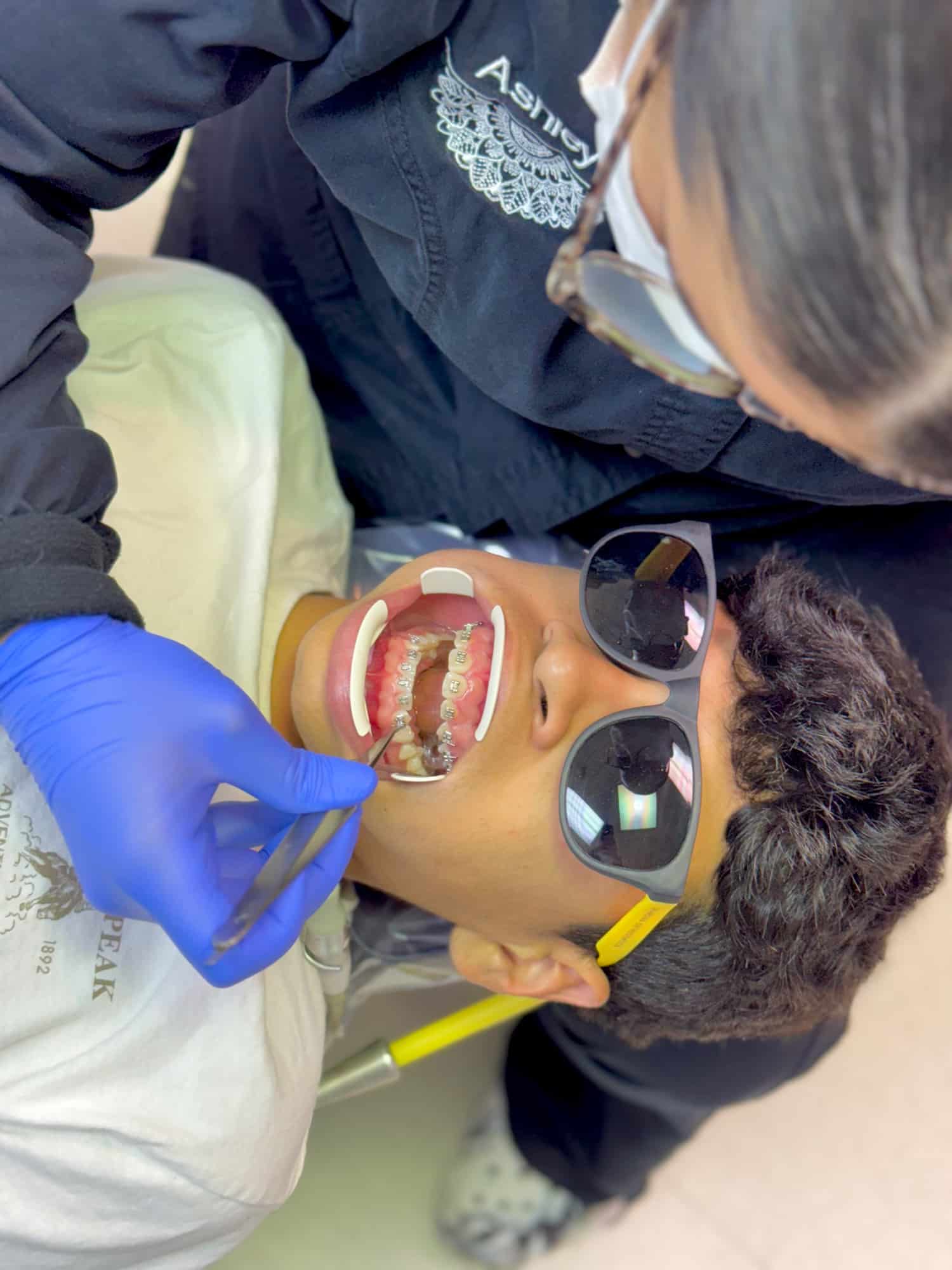 Traditional Metal Braces in Harrisonburg, VA