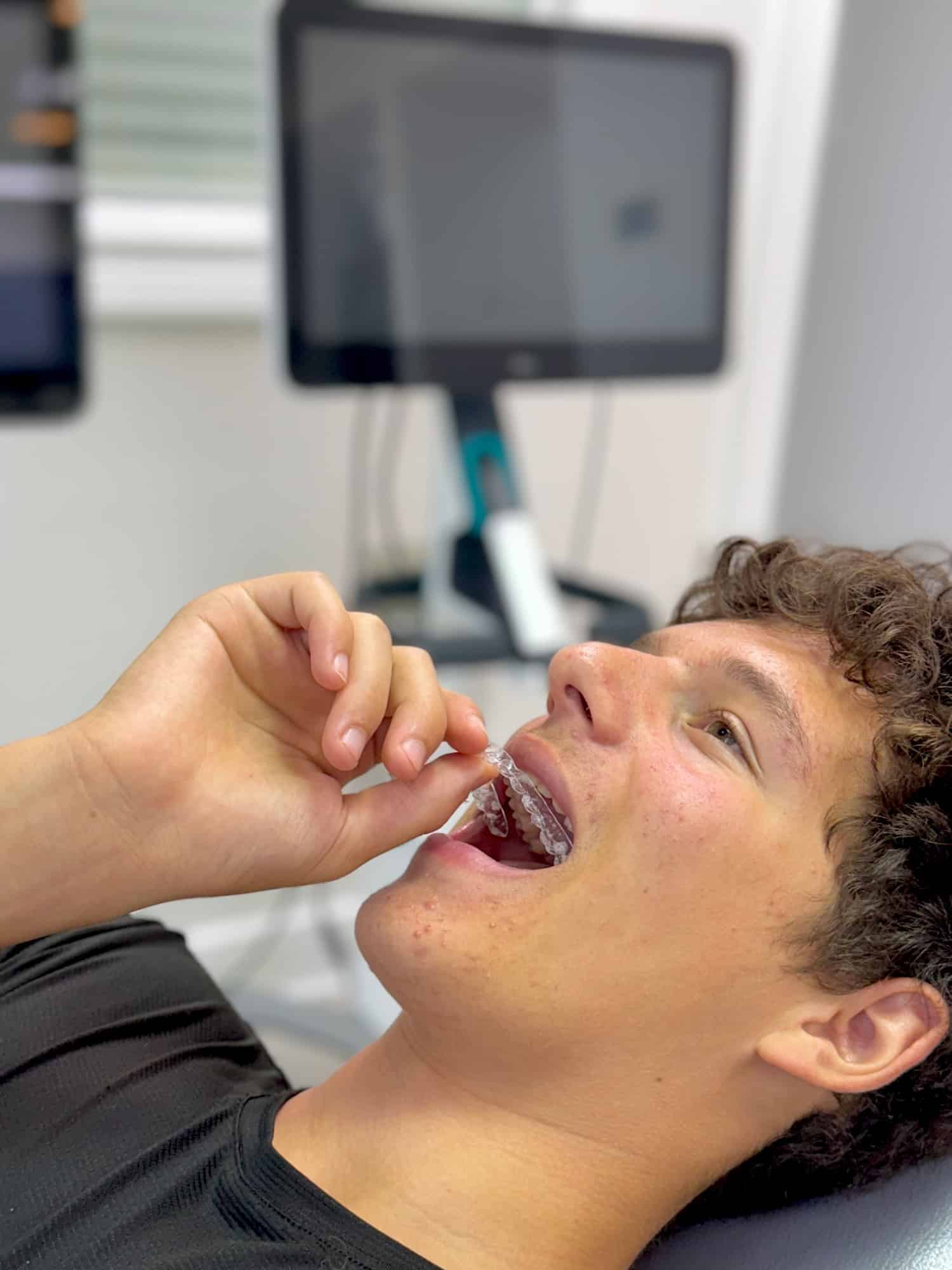 Male athlete inserting Invisalign clear aligners for sports in Harrisonburg, showing how athletes can play sports with orthodontic treatment
